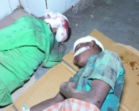 ଅନୁଗୁଳ : ୫୫ନମ୍ବର ଜାତୀୟ ରାଜପଥ ନିକଟରେ ଦୁର୍ଘଟଣା, ୩ ଶିଶୁ ଆହତ