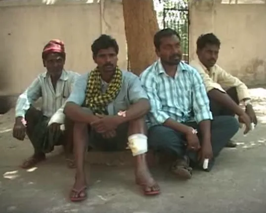 ରାଉରକେଲା ବିଶ୍ରା ବ୍ଲକରେ ଆନ୍ଥ୍ରାକ୍ସ ଆତଙ୍କ ! ଦୁଇ ଆକ୍ରାନ୍ତ ମୃତ, ୫ ଗୁରୁତର