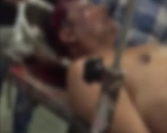 କଟକରେ ଦାଦାବଟି ଆଦାୟକୁ କେନ୍ଦ୍ର କରି ଫୁଟିଲା ବୋମା ! ୨ ଆହତ, କଟକ ବଡ ଡାକ୍ତରଖାନାରେ ଭର୍ତ୍ତି