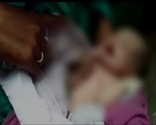 ମଧ୍ୟପ୍ରଦେଶର ବୁନ୍ଦେଲଖଣ୍ଡରେ ବିରଳ ଶିଶୁର ଜନ୍ମ ! ଶରୀର ବାହାରେ ରହିଛି ହୃତପିଣ୍ଡ