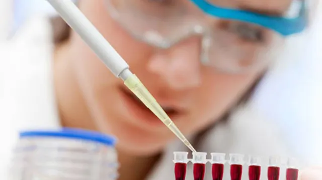 ଏବେ ପାଞ୍ଚ ବର୍ଷ ପୂର୍ବରୁ ଜଣା ପଡିବ କର୍କଟ ରୋଗ ! କରିବାକୁ ପଡିବ ଏକ ସ୍ୱତନ୍ତ୍ର ରକ୍ତପରୀକ୍ଷା