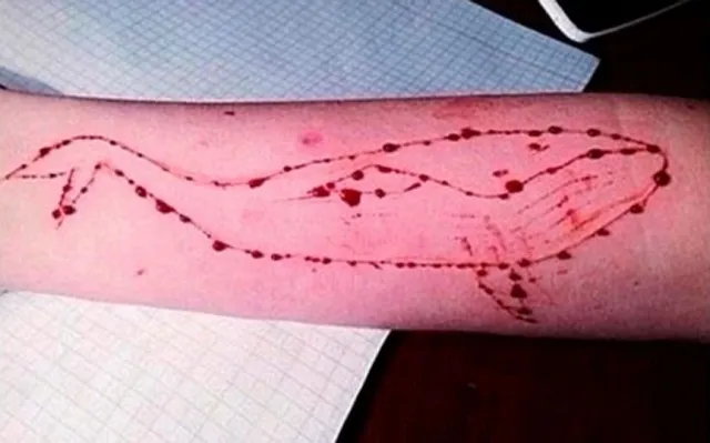 ମୃତ୍ୟୁର ଖେଳ କବଳରେ ଯୁବପୀଢି ! ବ୍ରହ୍ମପୁରରେ ନୀଳ ତିମି ପଂଝାରୁ ଉଦ୍ଧାର ହେଲେ ଇଂଜିନିୟରିଂ ଛାତ୍ର