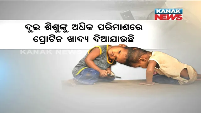 ଅଲଗା ହେବେ ଜଗା ବଳିଆ ! ଦିଲ୍ଲୀ ଏମ୍ସରେ ଚାଲିଛି ପ୍ରସ୍ତୁତି, ଲାଗିଛନ୍ତି ୪୦ ଜଣ ଡାକ୍ତରଙ୍କ ସହ ୬୦ ଜଣିଆ ଟିମ୍