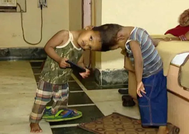 ଜଗାବଳିଆଙ୍କୁ ତିନିଦିନରୁ ଜ୍ୱର ! ସ୍ୱାସ୍ଥ୍ୟାବସ୍ଥା ସନ୍ତୋଷଜନକ