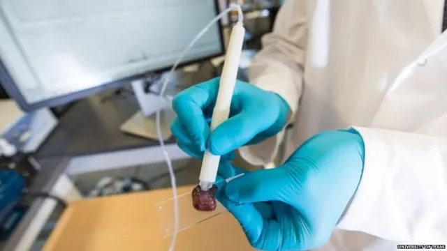 ବିଜ୍ଞାନ କ୍ଷେତ୍ରରେ ନୂଆ ମାଇଲଖୁଂଟ ! ମାତ୍ର ୧୦ ସେକେଣ୍ଡରେ କ୍ୟାନ୍ସରକୁ ଚିହ୍ନଟ କରିବ ଏହି ପେନ୍