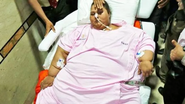 ଆଖି ବୁଜିଲେ ବିଶ୍ୱର ସବୁଠାରୁ ଓଜନିଆ ମହିଳା ଇମାନ୍ !