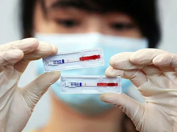 ଏବେ ସ୍ମାର୍ଟଫୋନରେ କେବଳ ୧୦ ମିନିଟରେ ଜାଣିପାରିବେ ଏଚଆଇଭି ସଂକ୍ରମଣ ବିଷୟ !