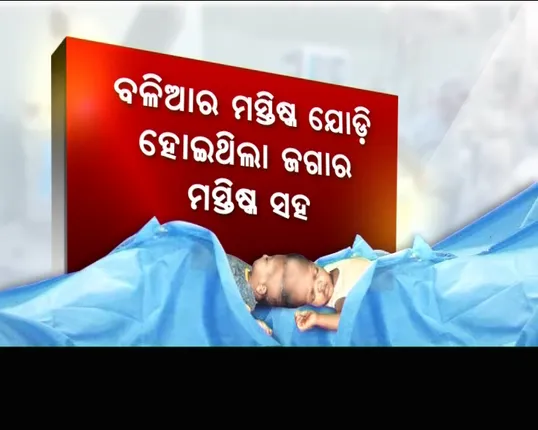ବଳିଆ ଖାଇଲେ ପୁରୁଥିଲା ଜଗାର ପେଟ ! ଗୋଟିଏ ଶରୀରରୁ ଆଉ ଗୋଟିଏ ଶରୀରକୁ ହେଉଥିଲା ରକ୍ତ ସଂଚାଳନ