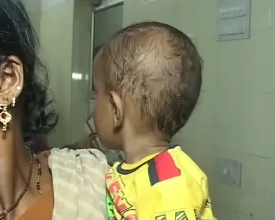 କୋରାପୁଟ : ଚେଙ୍କ ଚିକିତ୍ସାରେ ୮ ମାସ ଶିଶୁ ଗୁରୁତର