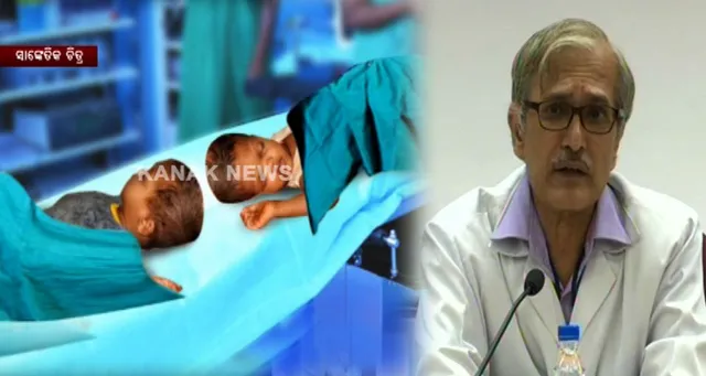 ଜଗା-ବଳିଆଙ୍କ ଅପରେସନ ପରେ ଦିଲ୍ଲୀ ଏମ୍ସ କର୍ତ୍ତୃପକ୍ଷଙ୍କ ପ୍ରେସମିଟ୍ : ଦୁଇ ଶିଶୁଙ୍କ ସ୍ୱାସ୍ଥ୍ୟ ପ୍ରତି ସତର୍କ ଦୃଷ୍ଟି ରଖାଯାଇଛି