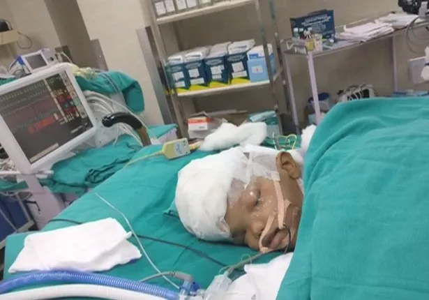 ଜଗା-ବଳିଆ ଅଲଗା ହେବା ପରେ ଦୁଇଟି ମସ୍ତିଷ୍କର ସଂଚାଳନ ଉପରେ ନଜର ରଖିଛନ୍ତି ବିଶେଷଜ୍ଞ : ଡାକ୍ତର କହିଲେ, ସ୍ୱତନ୍ତ୍ର ଭାବେ ଦୁଇ ମସ୍ତିଷ୍କ କାମ କରିବା ସବୁଠୁ ବଡ଼ ଚ୍ୟାଲେଂଜ