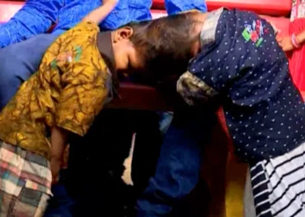 ଅଲଗା ହେବ ଯୋଡାମୁଣ୍ଡ ଶିଶୁ ଜଗା-ବଳିଆ ! ସକାଳ ୯ଟାରୁ ଦିଲ୍ଲୀ ଏମ୍ସରେ ଦ୍ୱିତୀୟ ପର୍ଯ୍ୟାୟ ଅପରେସନ ଆରମ୍ଭ