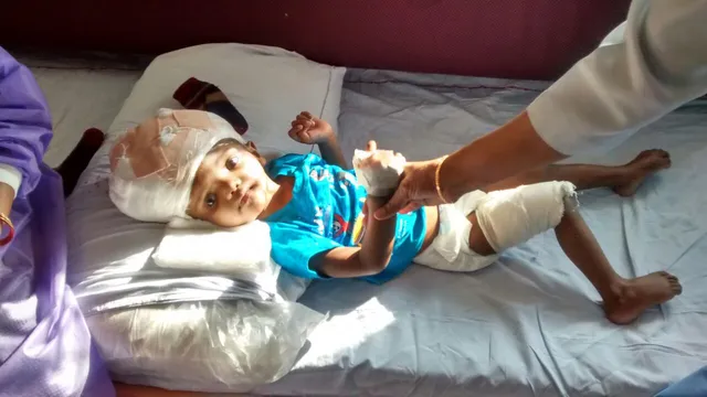 ଦିଲ୍ଲୀ ଏମ୍ସରୁ ଆସିଲା ଖୁସି ଖବର ! ବଳିଆର ସ୍ୱାସ୍ଥ୍ୟରେ ଉନ୍ନତି, ଭେଂଟିଲେଟରରୁ ବାହାରି ଆଇସିୟୁରେ ଚାଲିଛି ଚିକିତ୍ସା