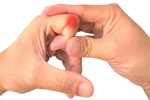 ଅଙ୍ଗୁଳିି ଫୁଟାଉଛନ୍ତି କି ? ସାବଧାନ . . . ଗଣ୍ଠି ସମସ୍ୟାରେ ପଡ଼ିପାରନ୍ତି