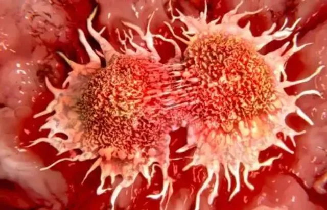 କ୍ୟାନସର କବଳରେ ଓଡିଶା ! ରାଜ୍ୟରେ ଦୈନିକ ୬୯ କର୍କଟ ରୋଗୀଙ୍କ ମୃତ୍ୟୁ ନେଇ କେନ୍ଦ୍ର ସ୍ୱାସ୍ଥ୍ୟ ମନ୍ତ୍ରାଳୟର ରିପୋର୍ଟ