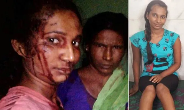 ଛେଳିକୁ ବଞ୍ଚାଇବା ପାଇଁ ନିଜ ଜୀବନକୁ ବାଜି ଲଗାଇଲେ ଯୁବତୀ! କ୍ଷତାକ୍ତ ଅବସ୍ଥାରେ ନେଲେ ସେଲଫି ।