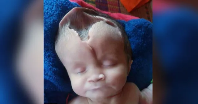 ଝୁଲନ୍ତା ଅବସ୍ଥାରେ କଅଁଳ ଜୀବନ ! ପଢନ୍ତୁ ଖପୁରୀ ବିହିନ ଜଣେ ଶିଶୁର କାହାଣୀ ।