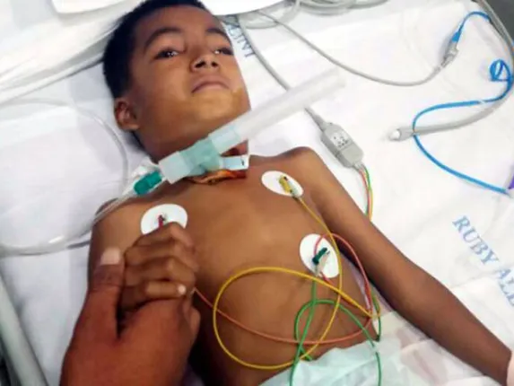 ଶିକ୍ଷକ ସାଜିଲେ ରାକ୍ଷସ ! ସାମାନ୍ୟ ଅଙ୍କ ଭୁଲ କରିବାରୁ ଦ୍ୱିତୀୟ ଶ୍ରେଣୀ ଛାତ୍ରର ଗଳାରେ ପୁରାଇଲେ କାଠଖଣ୍ଡ ।