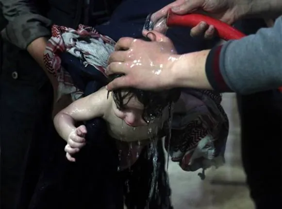 ନର୍କ ହେଲା ସିରିୟା! କୋମଳ ଛୁଆଙ୍କ ଏଭଳି ଲୋମଟାଙ୍କୁରା ଦୃଶ୍ୟ ଦେଖି ନ କାନ୍ଦି ରହିପାରିବେନି ।