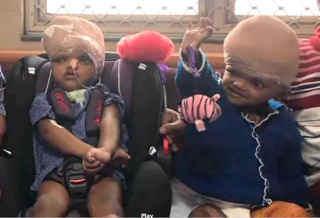 ଦିଲ୍ଲୀ ଏମ୍ସରୁ ଜଗା-ବଳିଆଙ୍କୁ ସ୍ଥାନାନ୍ତର କରାଯିବା ପ୍ରସଙ୍ଗ: ଜାତୀୟ ମାନାବାଧିକାର କମିସନଙ୍କ ନିକଟରେ ଏମ୍ସ ଦାଖଲ କରିଥିବା ରିପୋର୍ଟର ଜବାବ ରଖିଲେ ଆବେଦନକାରୀ