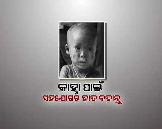 ଅସାଧ୍ୟ ଚର୍ମରୋଗରେ ପୀଡ଼ିତ ୩ ବର୍ଷର କାହ୍ନା ! ସାହାଯ୍ୟ ଲୋଡ଼ୁଛନ୍ତି ପରିବାର, ଆପଣଙ୍କ ସହଯୋଗ ବଦଳାଇ ଦେବ ଏକ ନିରୀହ ଶିଶୁର ଜୀବନ