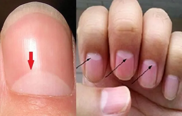 ନଖ ଉପରେ ଧଳା ଅର୍ଦ୍ଧଚନ୍ଦ୍ରର ଅର୍ଥ କ’ଣ ? ଆପଣ ଜାଣିଛନ୍ତି କି?