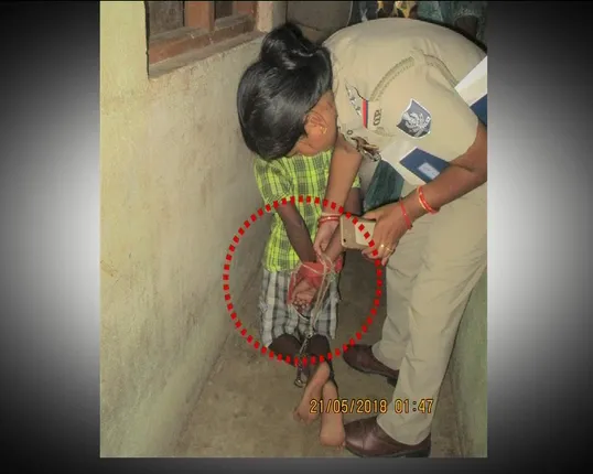 କଟକରେ ଗୋଡ ହାତ ବାନ୍ଧି ରଖିଥିବା ଶିଶୁକୁ ଉଦ୍ଧାର କଲା ଚାଇଲ୍ଡ ଲାଇନ : ମାଆ ଛାଡି ଚାଲିଗଲା ପରେ ଶାରୀରିକ ନିର୍ଯାତନା ଦେଉଥିଲେ ସଂପର୍କୀୟ