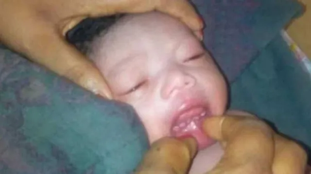 ୫ଟି ଦାନ୍ତ ସହ ଜନ୍ମ ନେଲା ଶିଶୁ । ଡାକ୍ତର ହୋଇଗଲେ ଆଶ୍ଚର୍ଯ୍ୟ, ଲୋକ କହିଲେ ଜନ୍ମ ନେଲେ ଅବତାରୀ ପୁରୁଷ