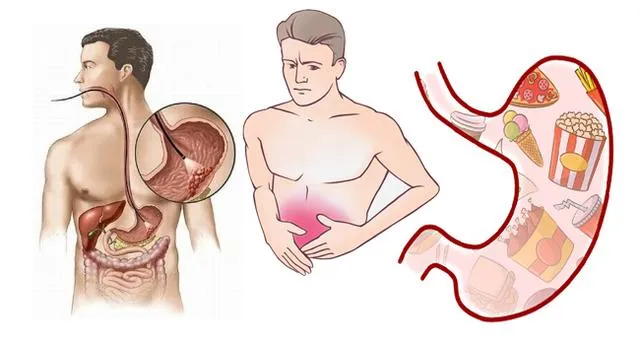 ଗ୍ୟାସ୍ ସମସ୍ୟାରୁ କିଭଳି ପାଇବେ ନିସ୍ତାର ! ଜାଣିରଖନ୍ତୁ ।