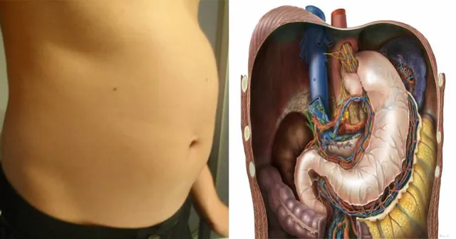 ପେଟ ଫୁଲିବା ଭଳି ସମସ୍ୟା ଦେଖାଯାଉଥିଲେ ୨୪ ଘଣ୍ଟା ମଧ୍ୟରେ କରନ୍ତୁ ଏହି କାମ ! ସମସ୍ୟାରୁ ମୁକ୍ତି ମିଳିବ ।