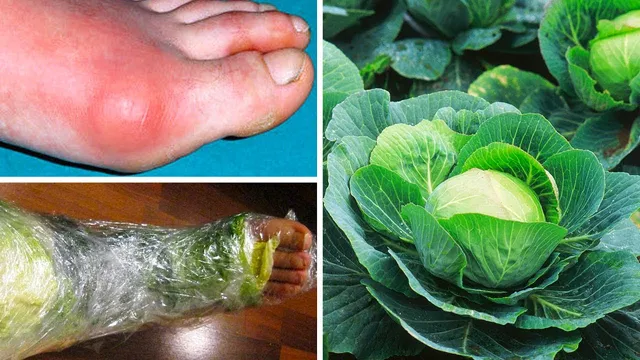 ଗଣ୍ଠି ସମସ୍ୟାକୁ ଦୂର କରେ ବନ୍ଧାକୋବି ପତ୍ର ! କିଭଳି ବ୍ୟବହାର କରିବେ ଜାଣିରଖନ୍ତୁ ।