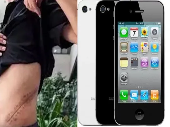 ବନ୍ଧୁଙ୍କ ନିକଟରେ ଦେଖେଇ ହେବା ପାଇଁ କିଡନୀ ବିକି କିଣିଥିଲେ ଆଇଫୋନ !  ୭ ବର୍ଷ ହେଲା ହସ୍ପିଟାଲ ବେଡରେ ପଡି ମୃତ୍ୟୁ ସହ ସଂଗ୍ରାମ କରୁଛନ୍ତି ଯୁବକ