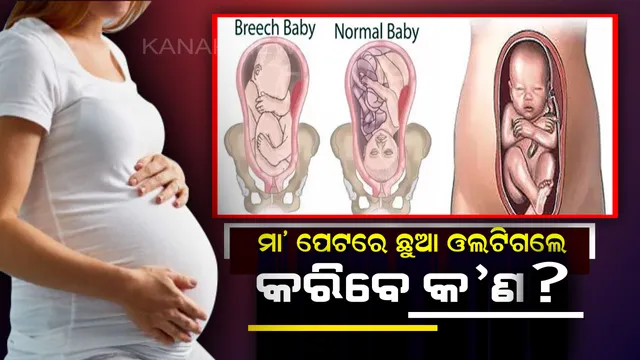ଗର୍ଭବତୀ ମହିଳାଙ୍କ ପେଟରେ ଛୁଆ ଓଲଟିଗଲେ କରନ୍ତୁ ଏହି କାମ ! ବଞ୍ଚାଇପାରିବେ ଉଭୟ ମା’ ଓ ଛୁଆର ଜୀବନ । 
