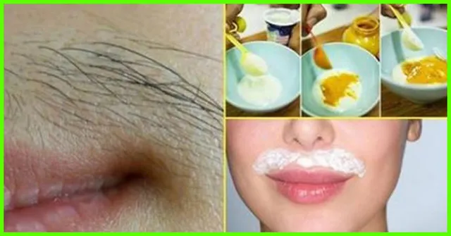 ମୁହଁରେ ଉଠୁଥିବା କେଶକୁ ନେଇ ଚିନ୍ତିତ କି ? ତେବେ ବ୍ୟବହାର କରନ୍ତୁ କିଛି ଉପଚାର