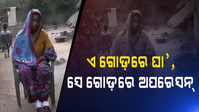 ଏମିତି ଡାକ୍ତରଙ୍କୁ ଦୁରୁଜୁହାର ! ଗୋଟିଏ ଗୋଡରେ ହୋଇଥିଲା ଘା, ଅନ୍ୟ ଗୋଡରେ କରିଦେଲେ ଅପରେସନ ।