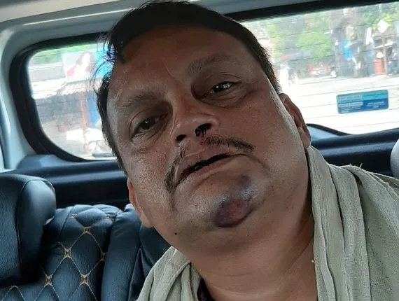 ସମ୍ବଲପୁରରୁ ଆସିଲା ଅଭାବନୀୟ ଚିତ୍ର ! ଥାନା ଭିତରେ ପୋଲିସ-ପୋଲିସ ମଧ୍ୟରେ ମାରପିଟ ! ଚିକିତ୍ସା ପାଇଁ ମେଡିକାଲରେ ଭର୍ତ୍ତି