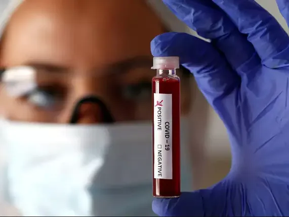 ରାଷ୍ଟ୍ରପତି ଭବନରେ ଜଣେ କରୋନା ଚିହ୍ନଟ ! ସଫେଇ କାର୍ଯ୍ୟରେ ନିୟୋଜିତ ଥିବା କର୍ମଚାରୀଙ୍କ ସମ୍ପର୍କୀୟ ପଜିଟିଭ୍ ଚିହ୍ନଟ ହୋଇଥିବା ଜାତୀୟ ଗଣମାଧ୍ୟମରେ ଖବର