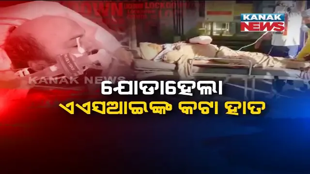 ଲକଡାଉନ : ପାସ୍ ମାଗିବାରୁ ପୋଲିସ ଏଏସଆଇଙ୍କ ହାତ ହାଣିଦେଇଥିଲେ, ସାଢେ ସାତ ଘଣ୍ଟାର ଅପରେସନ ପରେ କଟା ହାତକୁ ଯୋଡିଲେ ଡାକ୍ତର ।