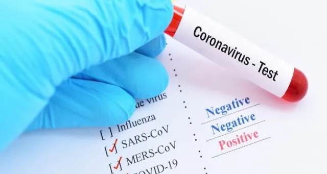 ରାଜ୍ୟରେ ଦିନକରେ ୧୪,୩୩୫ କରୋନା ପରୀକ୍ଷା । ପ୍ରତିଷ୍ଠା ହେବ ଆଉ ୬ ପରୀକ୍ଷାଗାର । ଦୈନିକ ୨୦ ହଜାନ ନମୁନା ପାଇଁ ଭିତ୍ତିଭୂମି ପ୍ରସ୍ତୁତ