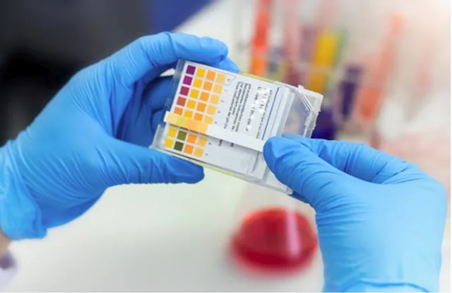 ଏଣିକି ମାତ୍ର ଅଧଘଂଟାରେ ହୋଇପାରିବ କରୋନା ପରୀକ୍ଷା: ଟାଟାର ସ୍ୱଦେଶୀ କୋଭିଡ଼ ଟେଷ୍ଟ କିଟ୍ ଫେଲୁଦାକୁ ଡିସିଜିଆଇର ଅନୁମୋଦନ; ଆରଟିପିସିଆର୍ ଟେଷ୍ଟ ଭଳି ଭରସାଯୋଗ୍ୟ