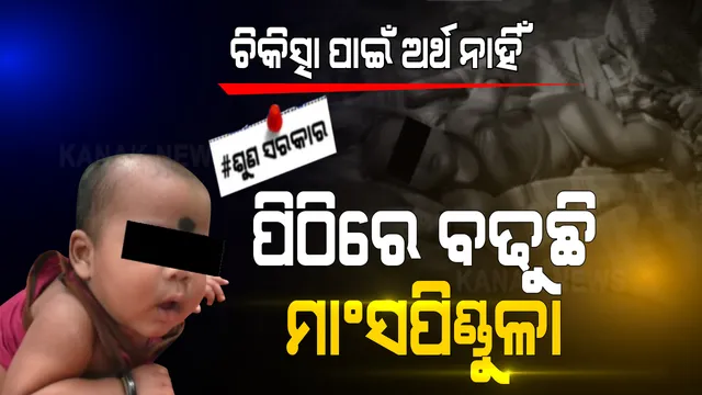 ଚିକିତ୍ସା ପାଇଁ ପୁଣି ବାଧକ ସାଜିଲା ଟଙ୍କା । ୬ ମାସ ଶିଶୁ ପୁତ୍ର ପିଠିରେ ଅସ୍ୱାଭାବିକ ଭାବରେ ବଢିଚାଲିଛି ମାଂସ ପିଣ୍ଡୁଳା, ସରକାରୀ ସହାୟତା ଦେବାକୁ ଗୁହାରି କରୁଛି ପରିବାର