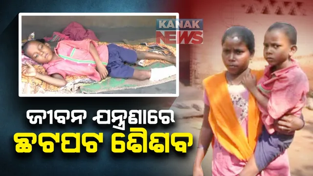 ଜୀବନ ଯନ୍ତ୍ରଣାରେ ଛଟପଟ ହେଉଛି ୫ବର୍ଷର ଶିଶୁ : ଉପଯୁକ୍ତ ଚିକିତ୍ସା ଅଭାବରୁ ବଢିଚାଲିଛି ଜୱାର ବାଦ୍ରାର କଷ୍ଟ; ଚିକିତ୍ସା ପ୍ରତିଶ୍ରୁତି ଦେଲେ ଦାନଗଦି ବିଡିଓ 
