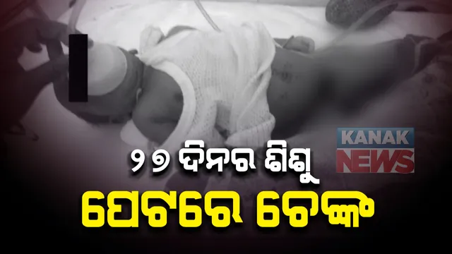 ବାରିପଦାରେ ଅନ୍ଧବିଶ୍ୱାସର କରୁଣ ପରିଣତି । ୨୭ଦିନର ଶିଶୁ ପେଟରେ ଚେଙ୍କ, ହସ୍ପିଟାଲରେ ଚିକିତ୍ସା ବେଳେ ମୃତ୍ୟୁ ।