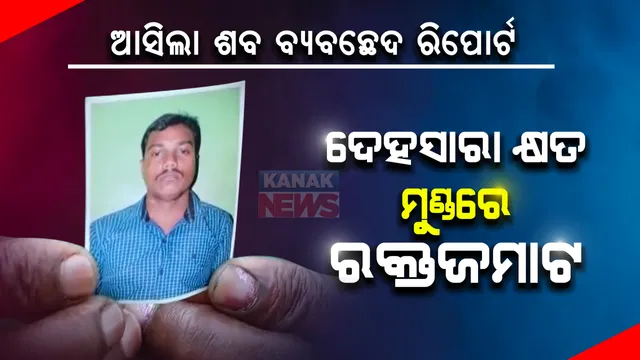 ପୁରୀ ହାଜତ ମୃତ୍ୟୁ ଘଟଣା : ଶବ ବ୍ୟବଚ୍ଛେଦ ରିପୋର୍ଟରେ ଚାଂଚଲ୍ୟ ତଥ୍ୟ; ମୃତ ରମେଶଙ୍କ ଦେହସାରା ରହିଛି କ୍ଷତ ଚିହ୍ନ