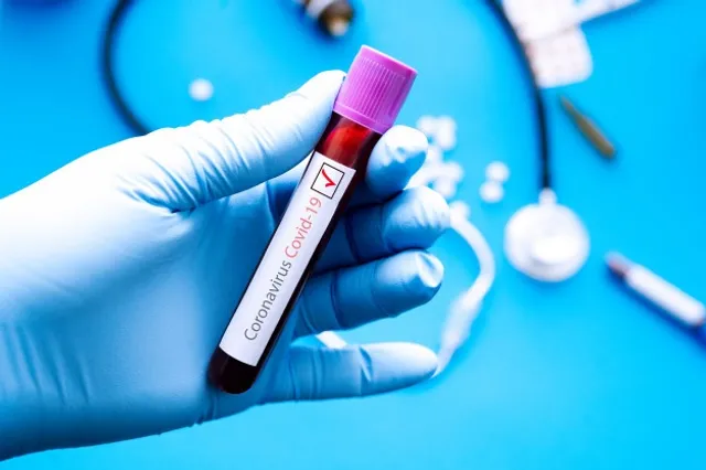 ସ୍ୱାସ୍ଥ୍ୟ ନିର୍ଦ୍ଦେଶକ ବିଜୟ ମହାପାତ୍ର କହିଲେ, ଟେଷ୍ଟ ବଢୁଥିବାରୁ ବଢୁଛି ସଂକ୍ରମଣ : ଦୈନିକ ୧୦ ହଜାର ସଂକ୍ରମଣକୁ ଆଖିରେ ରଖି ପ୍ରସ୍ତୁତି କରୁଛି ସ୍ୱାସ୍ଥ୍ୟ ବିଭାଗ