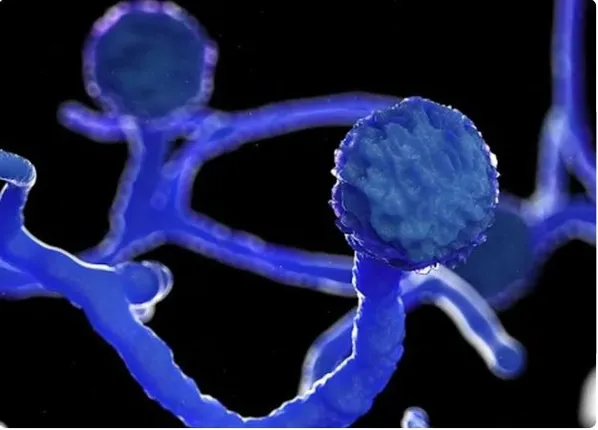 ଘାରିଲା ‘ବ୍ଲାକ୍ ଫଙ୍ଗସ୍’ ଭୟ ! କରୋନାରୁ ସୁସ୍ଥ ହେବା ପରେ ଦୃଷ୍ଟି ଶକ୍ତି ହରାଉଛନ୍ତି ଲୋକେ