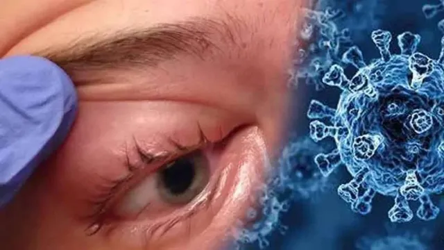 ବଢୁଥିବା 'ବ୍ଲାକ୍ ଫଙ୍ଗସ' ରୋଗୀଙ୍କୁ ନେଇ ସତର୍କ କରାଇଲେ ଦିଲ୍ଲୀ ଏମସ ମୁଖ୍ୟ । କହିଲେ, ଷ୍ଟେରଏଡର ଅପବ୍ୟବହାର କାରଣରୁ ବଢୁଛି ସଂକ୍ରମଣ