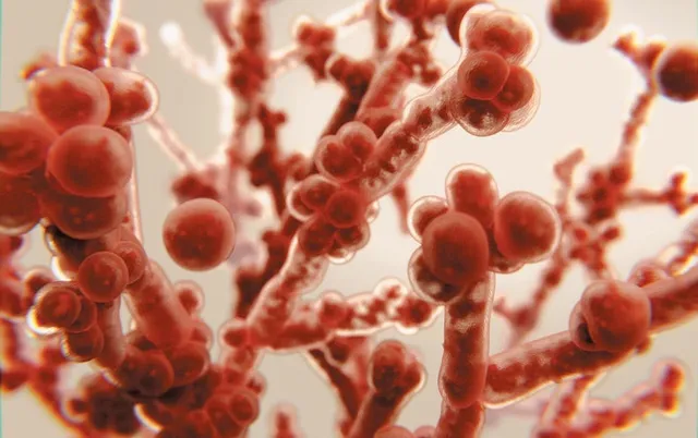 ଜଣେ ରୋଗୀଙ୍କ ଶରୀରରୁ ଚିହ୍ନଟ ହେଲା ୩ ପ୍ରକାର ଫଙ୍ଗସ, ଅସ୍ତ୍ରୋପଚାର ପାଇଁ ଲାଗିଲା ୩ ଘଣ୍ଟା । ବଞ୍ଚିଗଲା ରୋଗୀଙ୍କ ଜୀବନ ।