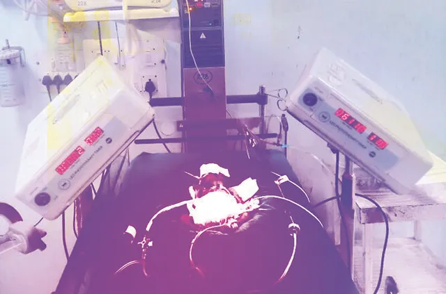 କଟକ ବଡ଼ ମେଡ଼ିକାଲରେ ଏକକାଳୀନ ୪ ଶିଶୁ ଜନ୍ମ ହେବା ଘଟଣା : ଜନ୍ମିତ ଶିଶୁଙ୍କ ଭିତରୁ ୩ ମୃତ, ଜଣଙ୍କ ଜୀବନ ବଞ୍ଚାଇବା ପାଇଁ କସରତ