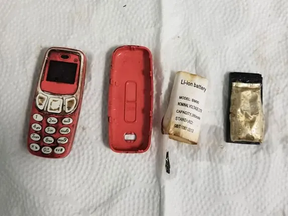 କଏଦୀ ପେଟରୁ ବାହାରିଲା ମୋବାଇଲ ଫୋନ୍ । ଏକ୍ସ-ରେ ଦେଖି ଆଶ୍ଚର୍ଯ୍ୟ ହୋଇଗଲେ ଡାକ୍ତର ।